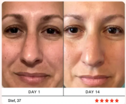 Revitalizing Eye Massager™