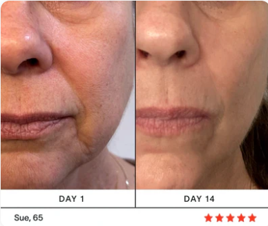 Revitalizing Eye Massager™